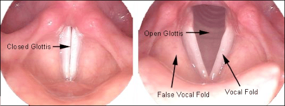another larynx